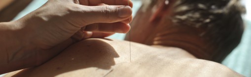 The therapist introduces the needle to the desired point on the patient's back
